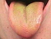 Eine grne Zunge nach dem Apfeltee